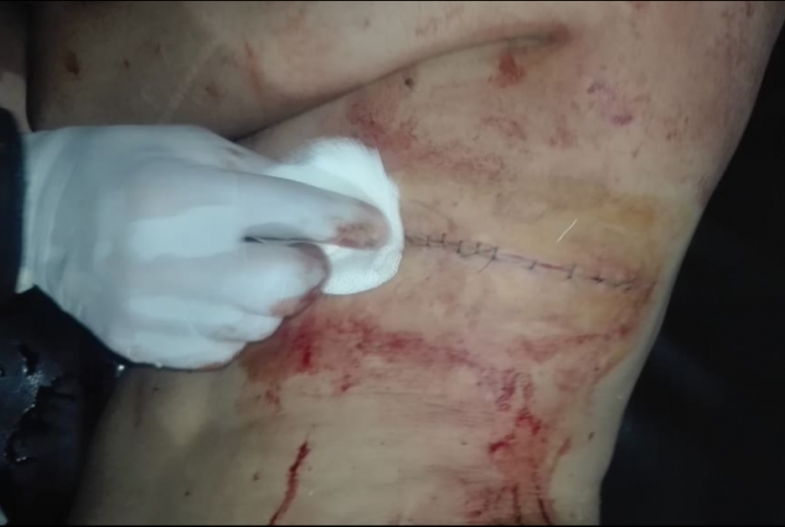  سائق يطعن شخصين بمطواة أثناء سيرهما في جنازة بالحسينية