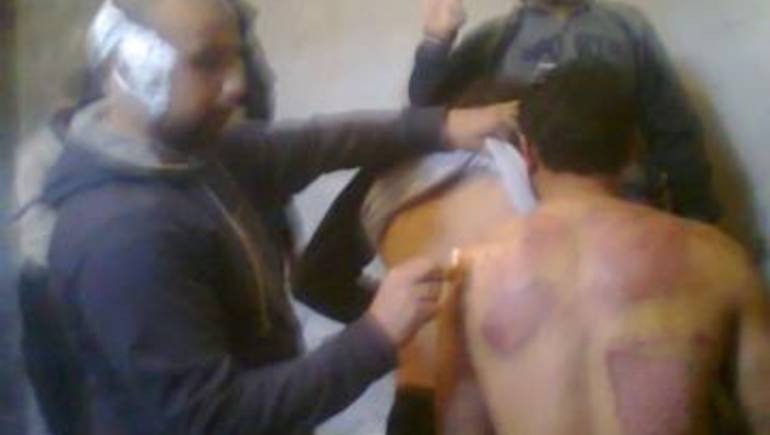  6 منظمات حقوقية: التعذيب في مصر منهج ثابت للانقلاب