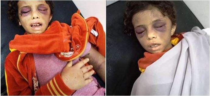  نعذيب طفل على يد عمته بسبب “التبول” في بلبيس